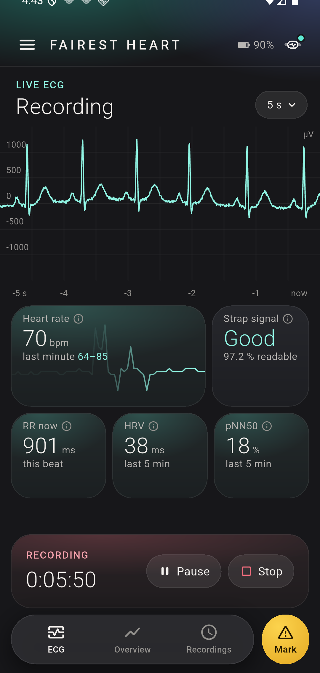 The ECG tab of Fairest Heart: a live trace, heart rate 70 bpm, strap signal Good, R-R 901 ms, HRV 38 ms, pNN50 18 %, a recording running
